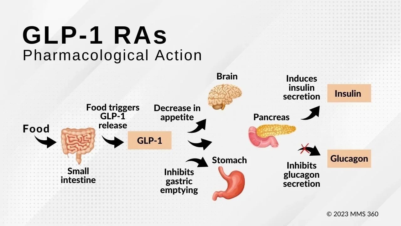 Hogyan hatnak a GLP-1-receptor-agonisták a bélre, a hasnyálmirigyre, a gyomorra és az agyra (ábra)
