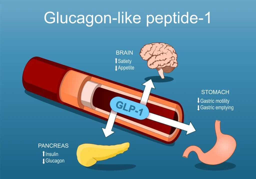 GLP-1-agonisták a szakirodalomban: szemaglutid, tirzepatid, kagrilintid és retatrutid
